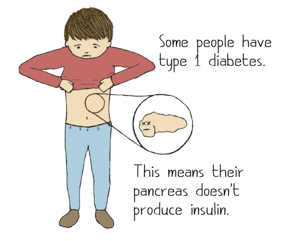 Cartoon of a boy looking at where his pancreas would be located on his abdomen with the words: "Some people have type 1 diabetes. This means their pancreas doesn't produce insulin."